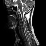 ストレートネッ君