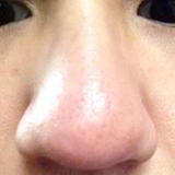 平野 亮 ちょんぺ